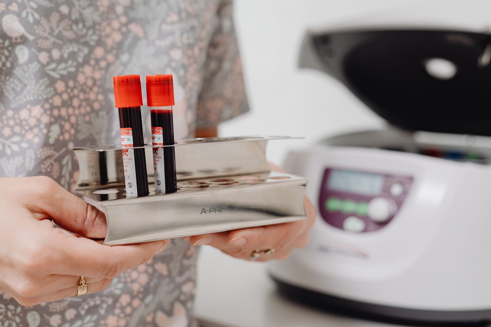 Clinical laboratory assessment of metabolic biomarkers and micronutrient levels for brain health.
